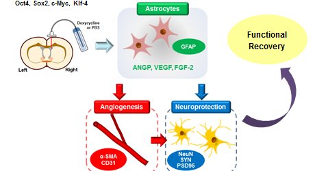 Molecular therapy: A possibility for treating stroke patients