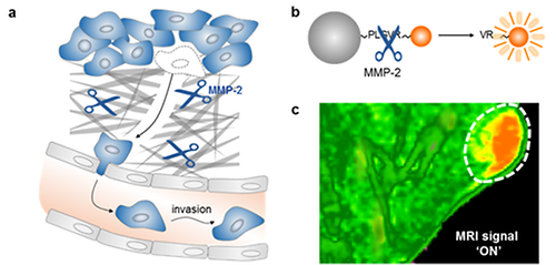 Smarter MRI Diagnosis with Nano MRI Lamp