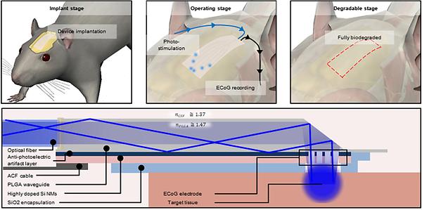 The World's First Fully Biodegradable Multifunctional Neural Implant System Developed